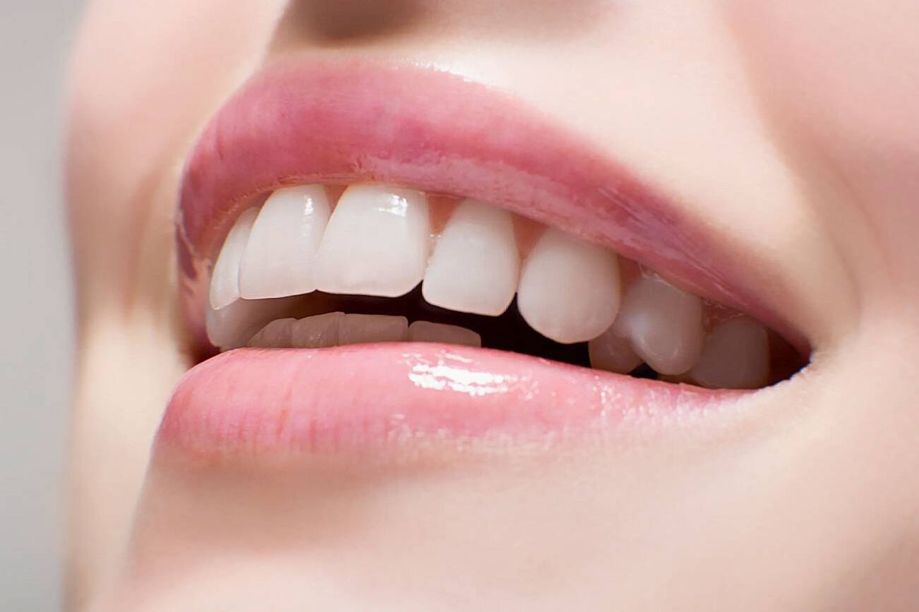 Teeth Whitening Kits